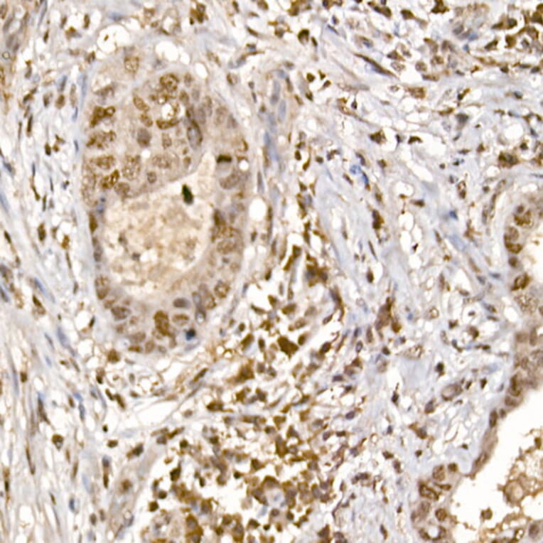 Immunohistochemistry - Anti-S6K1 (phospho Thr389) Antibody (A305998) - Antibodies.com