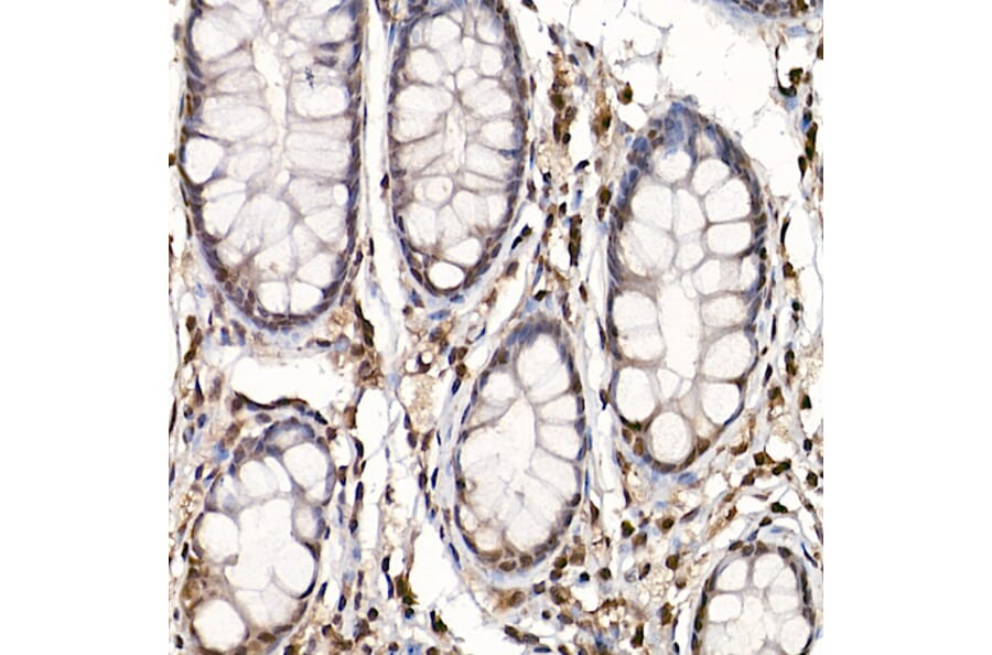 Immunohistochemistry - Anti-S6K1 (phospho Thr389) Antibody (A305998) - Antibodies.com