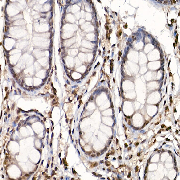 Immunohistochemistry - Anti-S6K1 (phospho Thr389) Antibody (A305998) - Antibodies.com