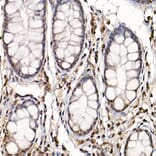 Immunohistochemistry - Anti-S6K1 (phospho Thr389) Antibody (A305998) - Antibodies.com