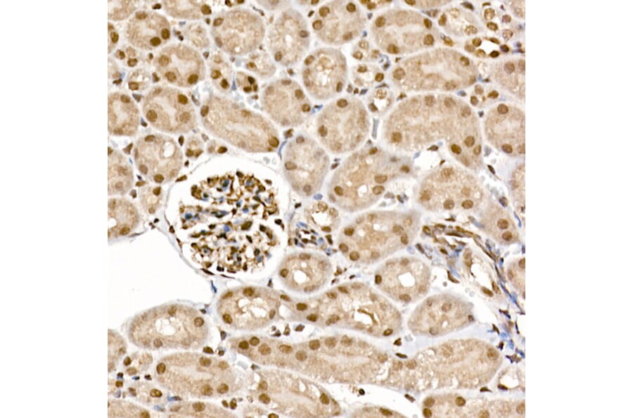 Immunohistochemistry - Anti-S6K1 (phospho Thr389) Antibody (A305998) - Antibodies.com