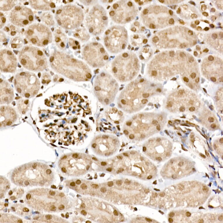 Immunohistochemistry - Anti-S6K1 (phospho Thr389) Antibody (A305998) - Antibodies.com