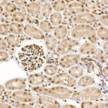 Immunohistochemistry - Anti-S6K1 (phospho Thr389) Antibody (A305998) - Antibodies.com