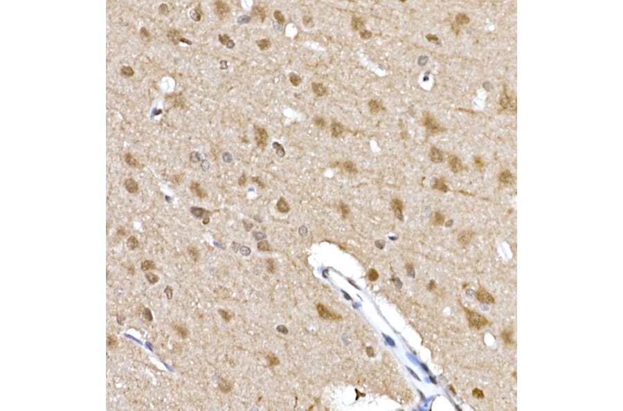 Immunohistochemistry - Anti-S6K1 (phospho Thr389) Antibody (A305998) - Antibodies.com