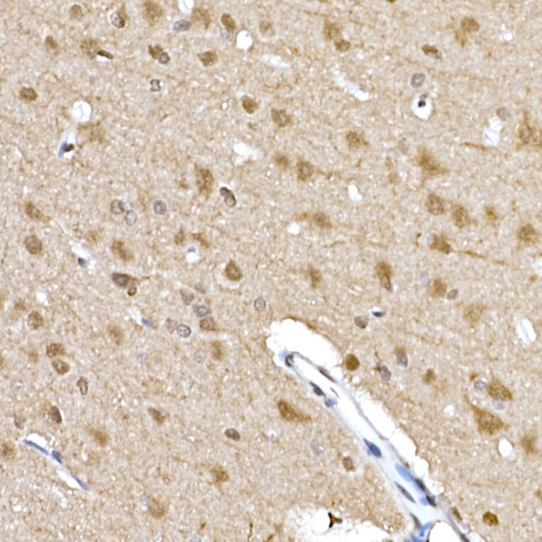 Immunohistochemistry - Anti-S6K1 (phospho Thr389) Antibody (A305998) - Antibodies.com