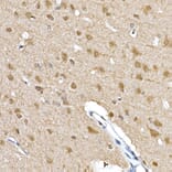 Immunohistochemistry - Anti-S6K1 (phospho Thr389) Antibody (A305998) - Antibodies.com