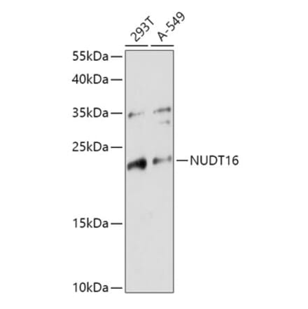 Western Blot - Anti-NUDT16 Antibody (A305999) - Antibodies.com