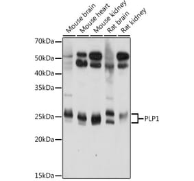 Western Blot - Anti-Myelin PLP Antibody (A306001) - Antibodies.com