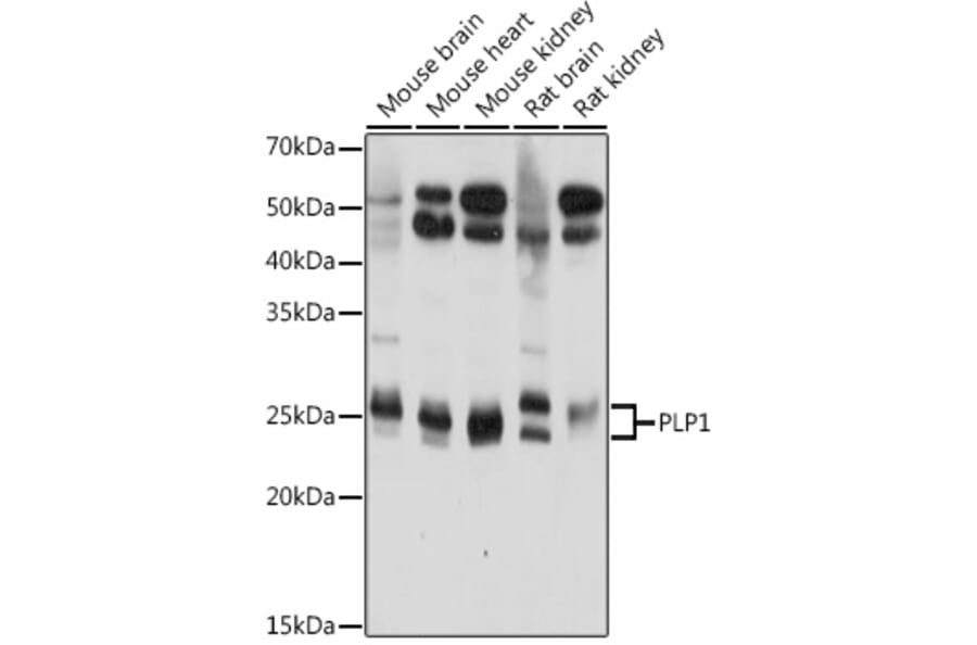 Western Blot - Anti-Myelin PLP Antibody (A306001) - Antibodies.com