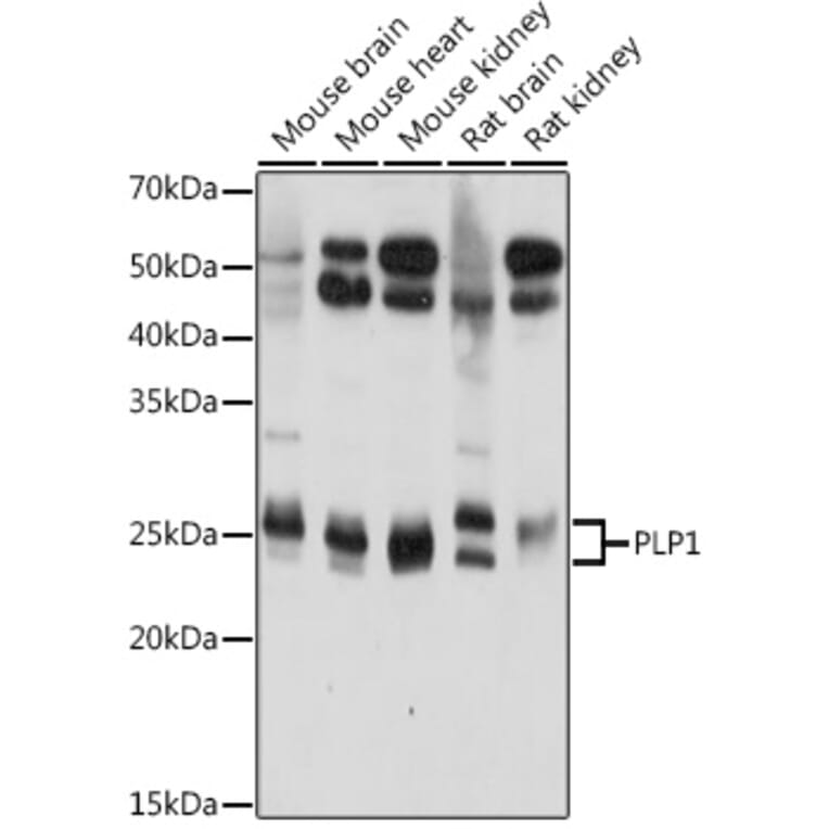 Western Blot - Anti-Myelin PLP Antibody (A306001) - Antibodies.com