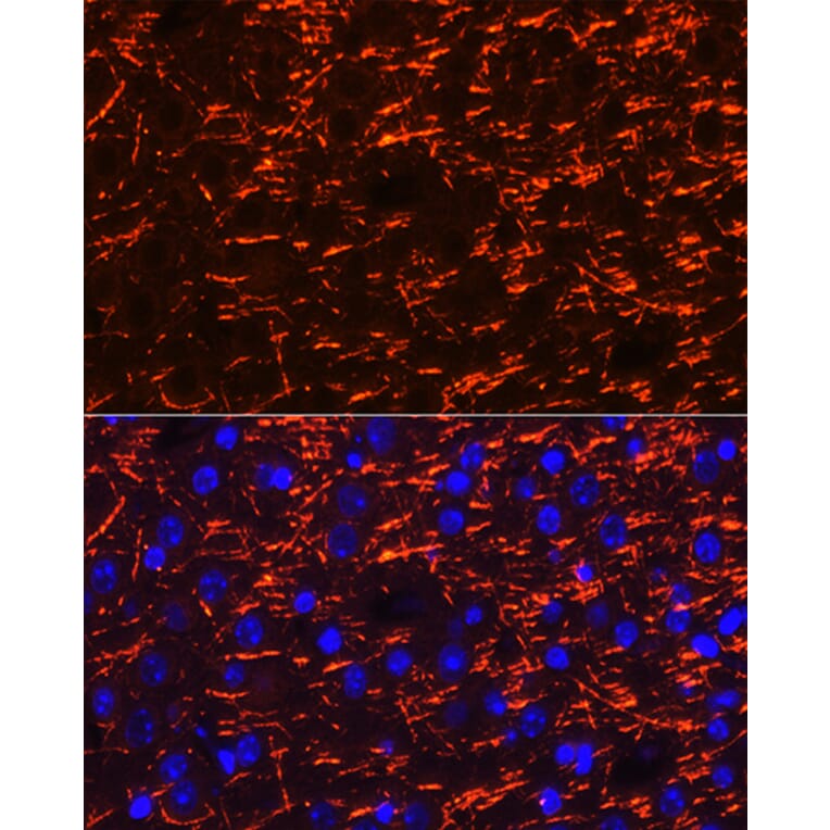 Immunofluorescence - Anti-Myelin PLP Antibody (A306001) - Antibodies.com