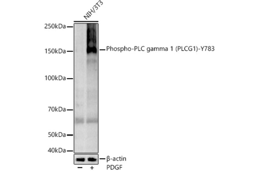 Western Blot - Anti-Phospholipase C gamma 1/PLC-gamma-1 (phospho Tyr783) Antibody [ARC54936] (A306002) - Antibodies.com