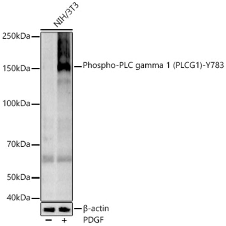Western Blot - Anti-Phospholipase C gamma 1/PLC-gamma-1 (phospho Tyr783) Antibody [ARC54936] (A306002) - Antibodies.com