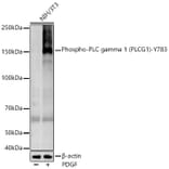 Western Blot - Anti-Phospholipase C gamma 1/PLC-gamma-1 (phospho Tyr783) Antibody [ARC54936] (A306002) - Antibodies.com