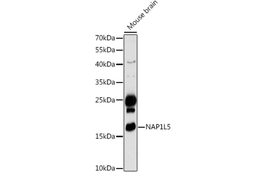 Western Blot - Anti-NAP1L5 Antibody (A306005) - Antibodies.com