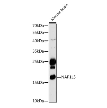Western Blot - Anti-NAP1L5 Antibody (A306005) - Antibodies.com