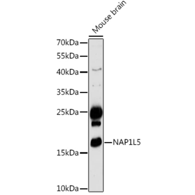 Western Blot - Anti-NAP1L5 Antibody (A306005) - Antibodies.com