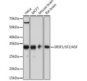 Western Blot - Anti-SF2 Antibody [ARC51453] (A306007) - Antibodies.com