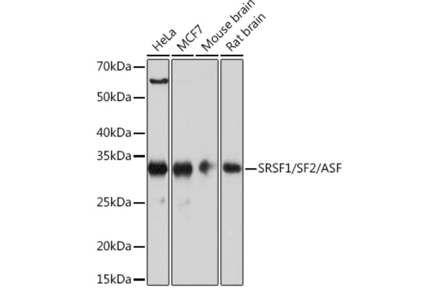 Western Blot - Anti-SF2 Antibody [ARC51453] (A306007) - Antibodies.com