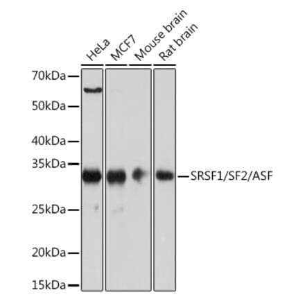 Western Blot - Anti-SF2 Antibody [ARC51453] (A306007) - Antibodies.com