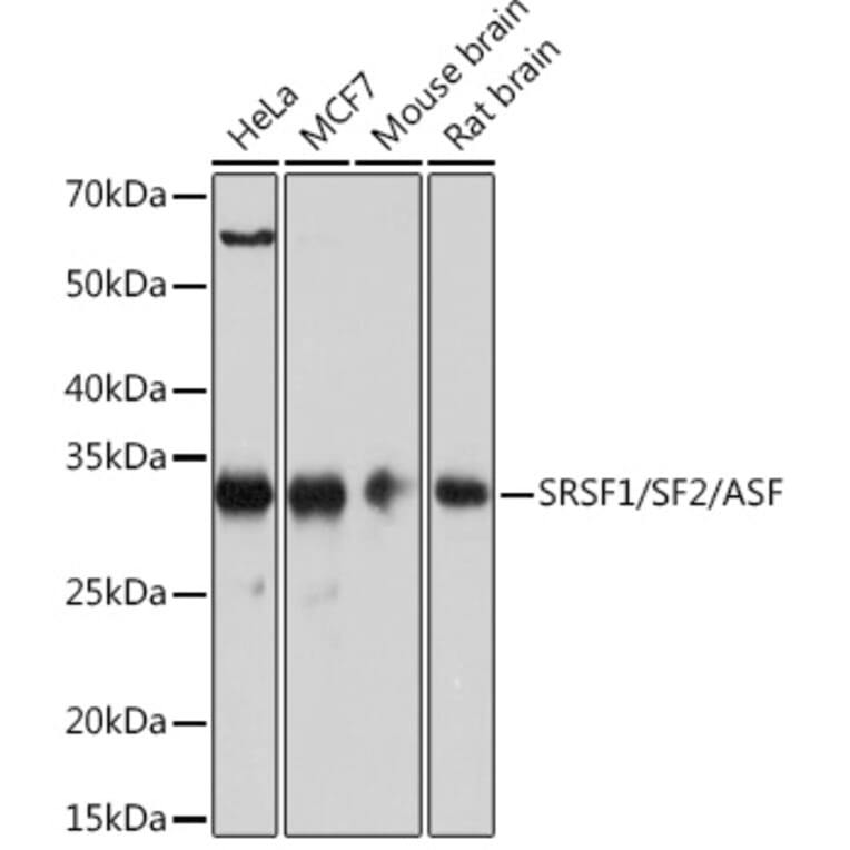 Western Blot - Anti-SF2 Antibody [ARC51453] (A306007) - Antibodies.com
