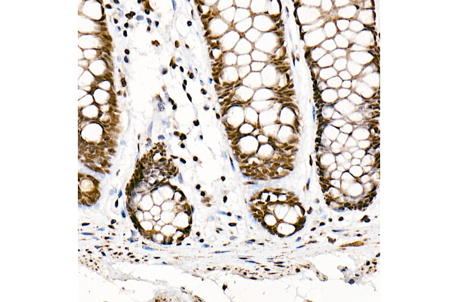 Immunohistochemistry - Anti-SF2 Antibody [ARC51453] (A306007) - Antibodies.com
