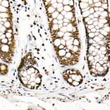 Immunohistochemistry - Anti-SF2 Antibody [ARC51453] (A306007) - Antibodies.com