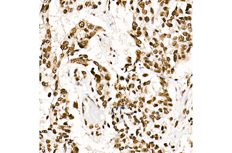 Immunohistochemistry - Anti-SF2 Antibody [ARC51453] (A306007) - Antibodies.com