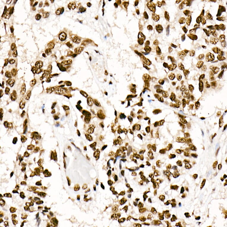 Immunohistochemistry - Anti-SF2 Antibody [ARC51453] (A306007) - Antibodies.com