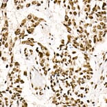 Immunohistochemistry - Anti-SF2 Antibody [ARC51453] (A306007) - Antibodies.com