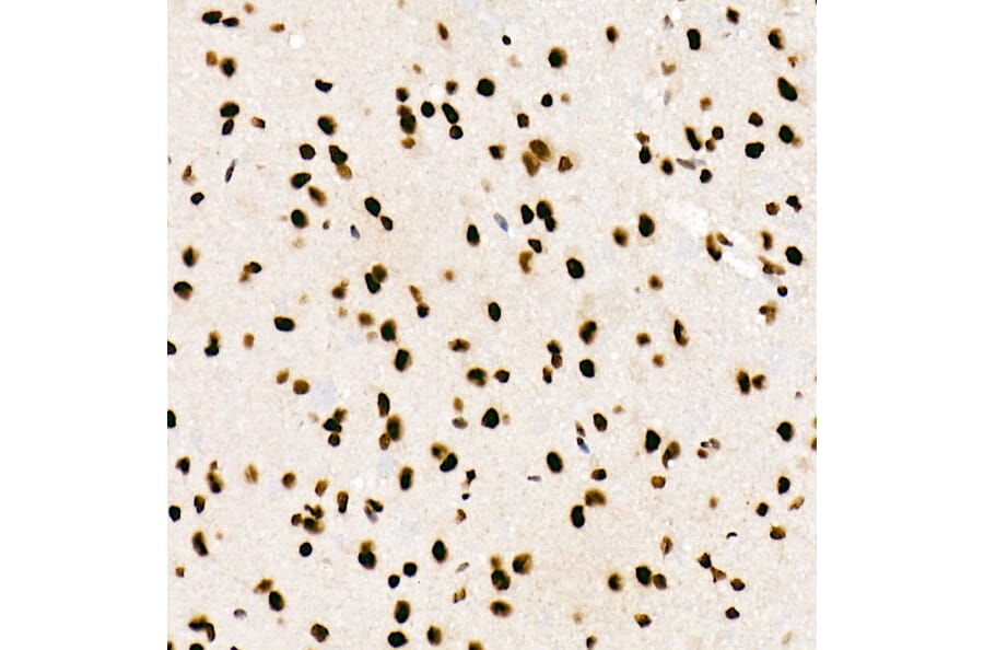 Immunohistochemistry - Anti-SF2 Antibody [ARC51453] (A306007) - Antibodies.com