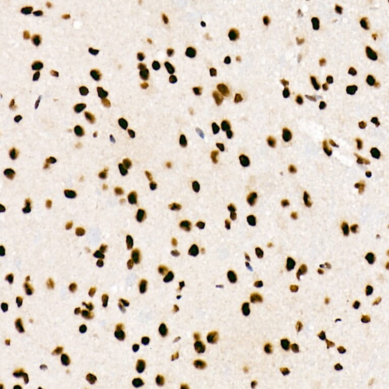 Immunohistochemistry - Anti-SF2 Antibody [ARC51453] (A306007) - Antibodies.com