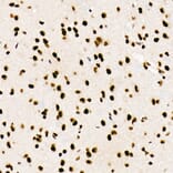 Immunohistochemistry - Anti-SF2 Antibody [ARC51453] (A306007) - Antibodies.com