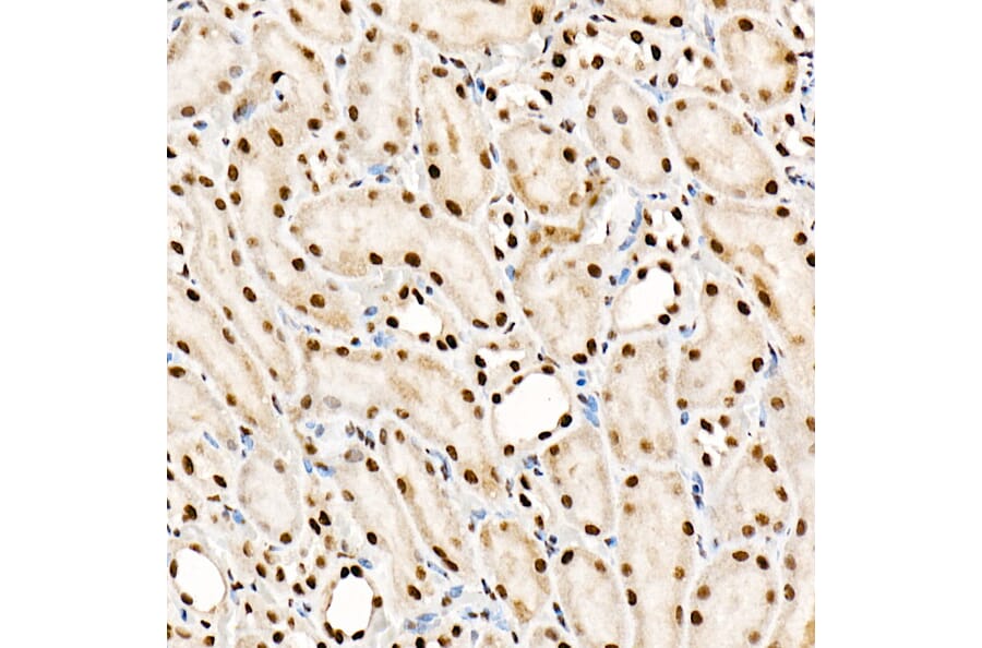 Immunohistochemistry - Anti-SF2 Antibody [ARC51453] (A306007) - Antibodies.com
