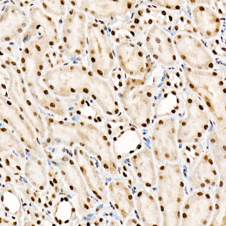 Immunohistochemistry - Anti-SF2 Antibody [ARC51453] (A306007) - Antibodies.com