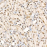Immunohistochemistry - Anti-SF2 Antibody [ARC51453] (A306007) - Antibodies.com
