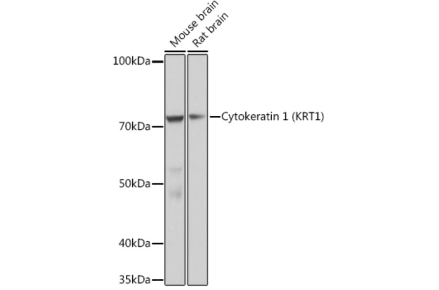 Western Blot - Anti-Cytokeratin 1 Antibody [ARC1745] (A306008) - Antibodies.com