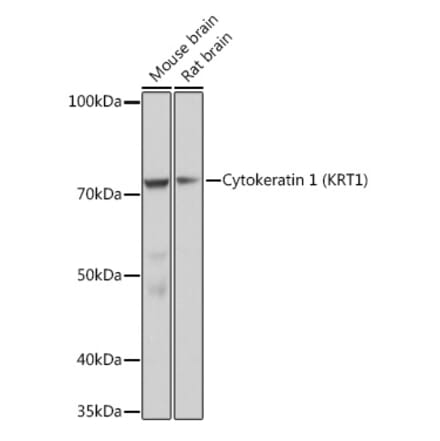 Western Blot - Anti-Cytokeratin 1 Antibody [ARC1745] (A306008) - Antibodies.com