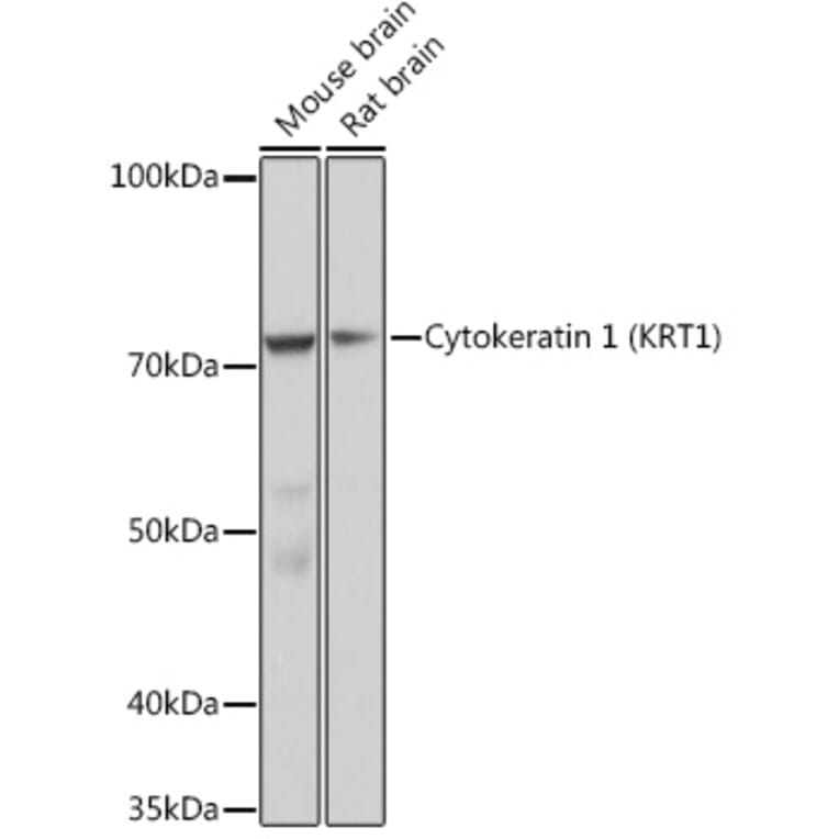 Western Blot - Anti-Cytokeratin 1 Antibody [ARC1745] (A306008) - Antibodies.com