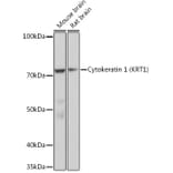 Western Blot - Anti-Cytokeratin 1 Antibody [ARC1745] (A306008) - Antibodies.com