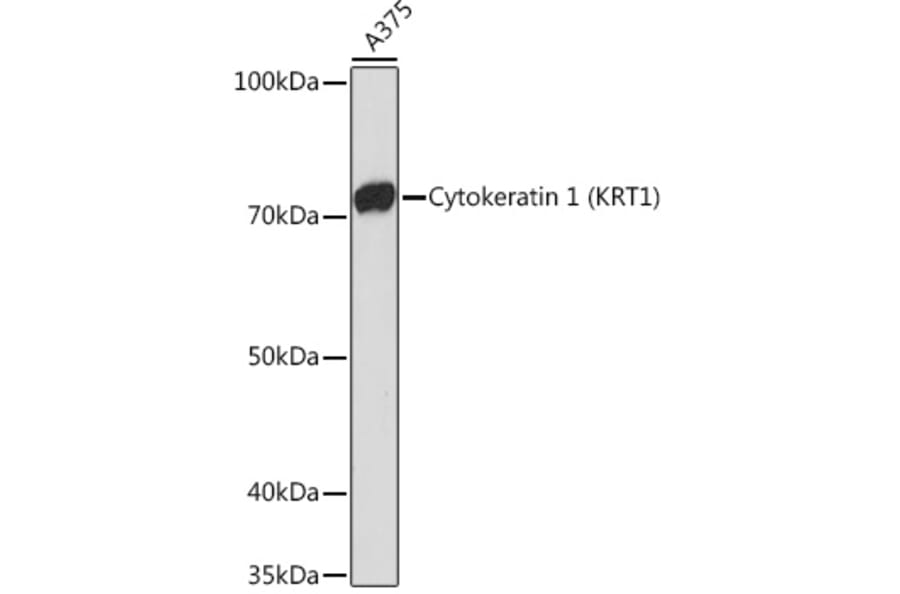 Western Blot - Anti-Cytokeratin 1 Antibody [ARC1745] (A306008) - Antibodies.com
