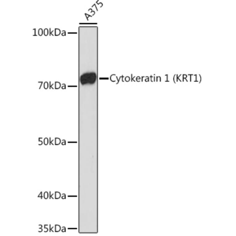 Western Blot - Anti-Cytokeratin 1 Antibody [ARC1745] (A306008) - Antibodies.com