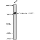 Western Blot - Anti-Cytokeratin 1 Antibody [ARC1745] (A306008) - Antibodies.com