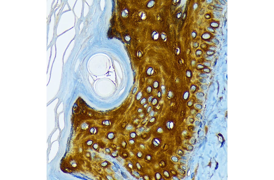 Immunohistochemistry - Anti-Cytokeratin 1 Antibody [ARC1745] (A306008) - Antibodies.com
