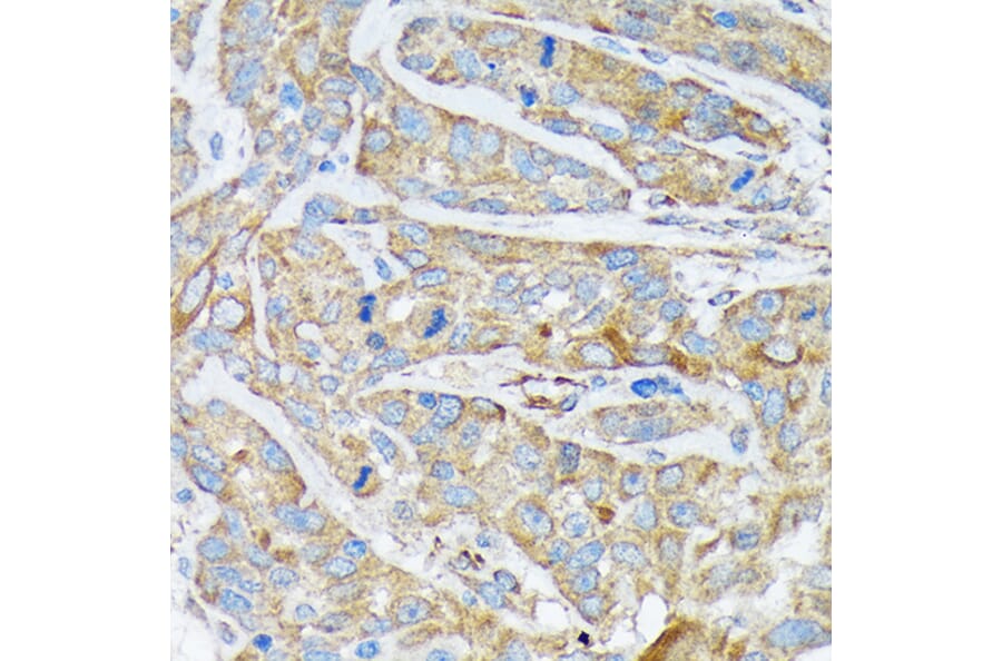 Immunohistochemistry - Anti-Cytokeratin 1 Antibody [ARC1745] (A306008) - Antibodies.com