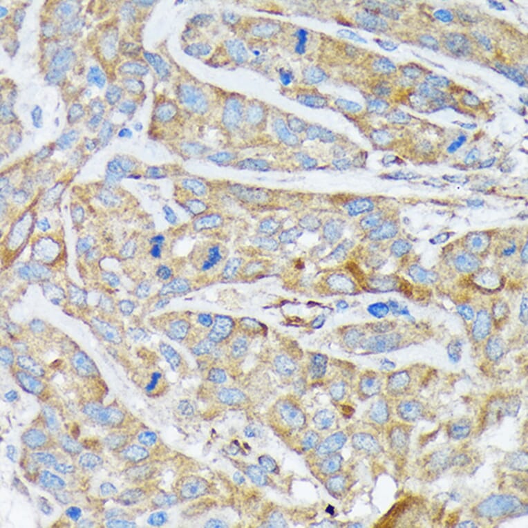 Immunohistochemistry - Anti-Cytokeratin 1 Antibody [ARC1745] (A306008) - Antibodies.com