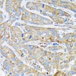 Immunohistochemistry - Anti-Cytokeratin 1 Antibody [ARC1745] (A306008) - Antibodies.com