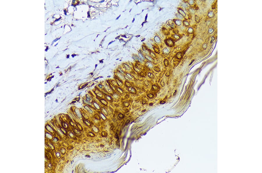Immunohistochemistry - Anti-Cytokeratin 1 Antibody [ARC1745] (A306008) - Antibodies.com