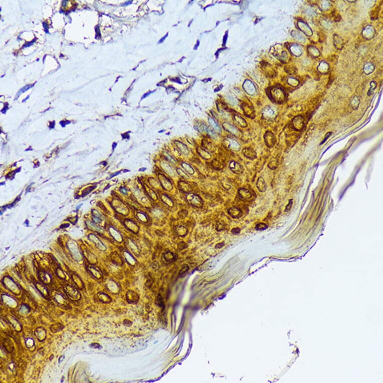 Immunohistochemistry - Anti-Cytokeratin 1 Antibody [ARC1745] (A306008) - Antibodies.com