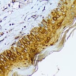 Immunohistochemistry - Anti-Cytokeratin 1 Antibody [ARC1745] (A306008) - Antibodies.com